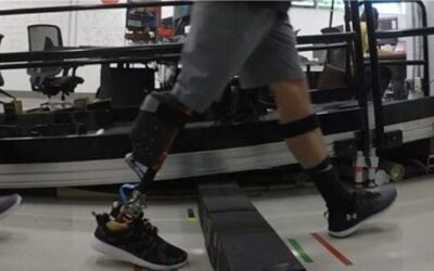 Prosthesis Control System Improves Obstacle Crossing