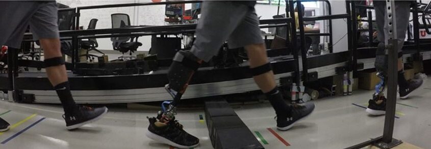 Prosthesis Control System Improves Obstacle Crossing