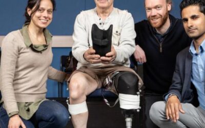 Scientists Develop Advanced Prosthetic Liners