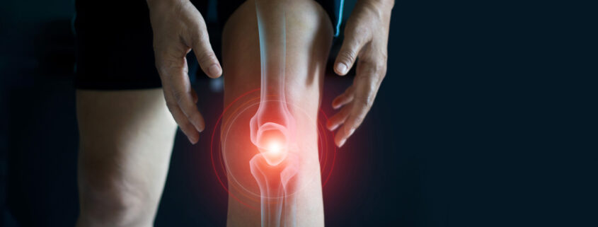Orthotics Helpful For Patients With Osteoarthritis