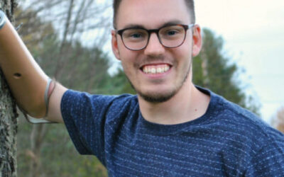 Green Prosthetics Patient Tells His Story To Amplitude