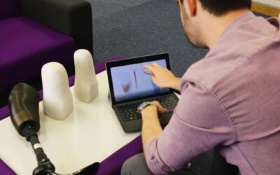 New Software May Help Practitioners With Socket Fit